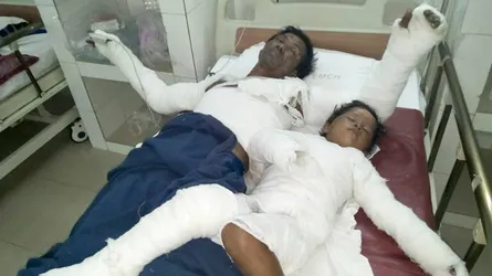 আগুনে লেগে একই পরিবারের ৪ জন দগ্ধ
