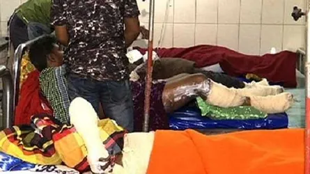 সোনারগাঁওয়ে দগ্ধ ১৩ শ্রমিকের মধ্যে ২ জনের মৃত্যু
