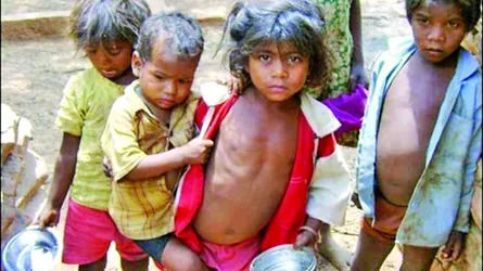 বিশ্বে অপুষ্টির শিকার এক তৃতীয়াংশ শিশু ভারতে