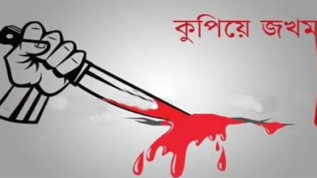 গজারিয়ায় সৈনিক লীগ নেতাকে কুপিয়ে জখম