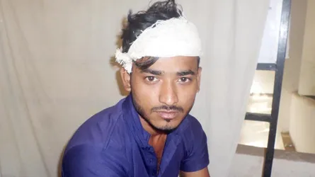 প্রেমিকার সাথে দেখা করতে এসে ফাটলো যুবকের মাথা