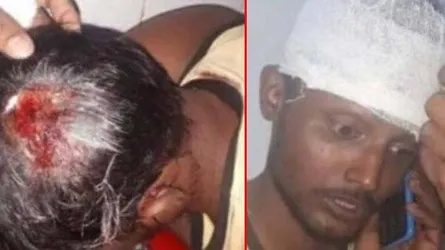 ধানের শীষ কর্মীদের মাথা ফাটাল কারা?