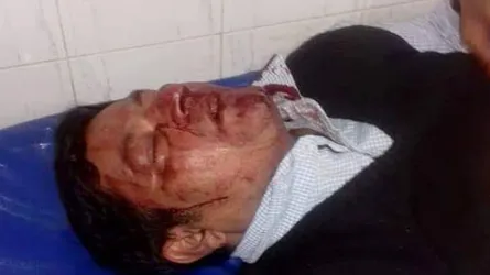 নরসিংদীতে মঈন খানের প্রচারণায় ফের হামলা