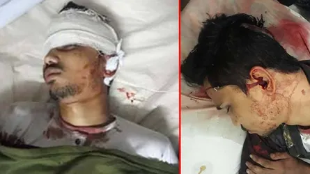খাবার বিতরণ নিয়ে ছাত্রলীগ দু’পক্ষের সংঘর্ষ, কুপিয়ে জখম