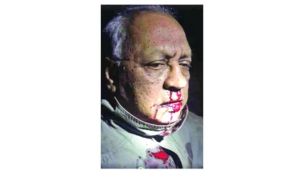 মেজর আখতারকে পিটিয়ে রক্তাক্ত করল পুলিশ