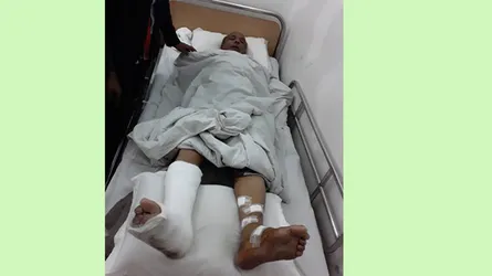 সীতাকুণ্ডে বিএনপি প্রার্থীর ভাইয়ের উপর বোমা হামলা