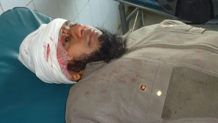 বরিশালে হাতপাখার কর্মীদের কুপিয়ে জখম