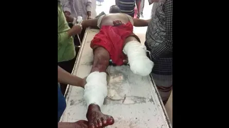 সিংড়ায় প্রতিপক্ষের বর্বরতার শিকার আ’লীগ নেতা