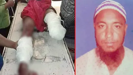 ৪ দিনেও আ’লীগ নেতার কেটে নেয়া পা উদ্ধার হয়নি