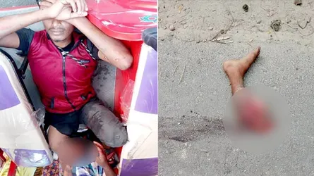 যেভাবে মোটরসাইকেল আরোহীর পা বিচ্ছিন্ন হয়ে গেল