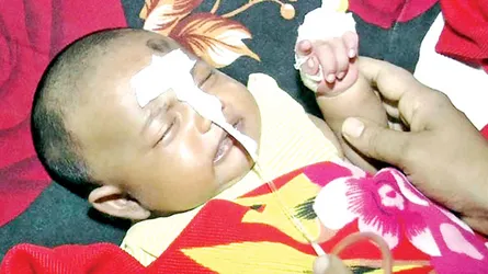 নিউমোনিয়া থেকে শিশুকে রক্ষায় করণীয়