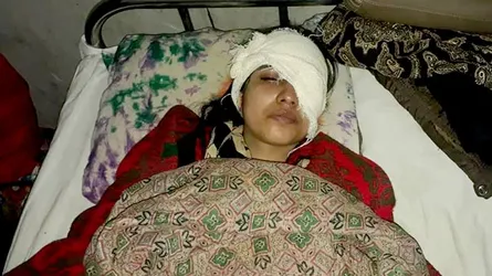 পিকনিকের গাড়ীতে হামলা, চোখ হারানোর পথে কলেজ ছাত্রী