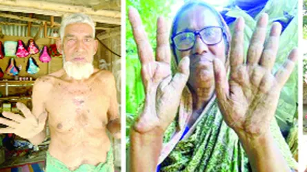 চৌগাছার দুটি গ্রামের প্রায় সবাই আর্সেনিকে আক্রান্ত
