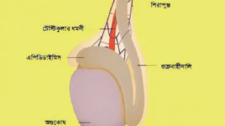 অণ্ডকোষে ব্যথার নানা কারণ
