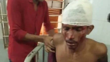 ছাত্রলীগ নেতার মাথা থেঁতলে দিল অপর গ্রুপের নেতাকর্মীরা