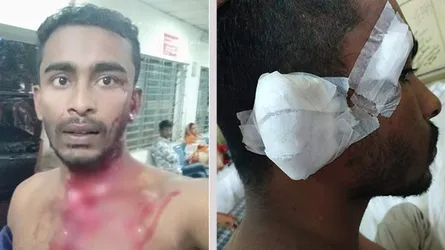 এবার বেধড়ক মারধরের শিকার সেই ছাত্রলীগ নেতা
