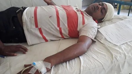 জামাইকে হাতুড়িপেটা করলেন শ্বশুর
