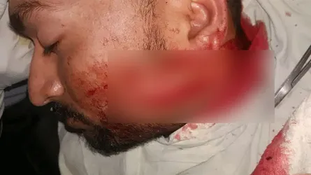 মাদক ব্যবসায় বাঁধা দেয়ায় যুবককে কুপিয়ে হত্যার চেষ্টা