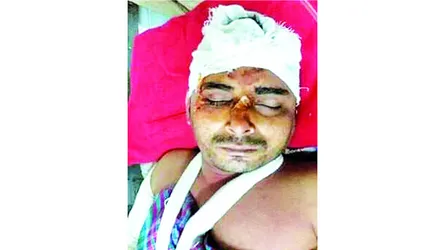গফরগাঁওয়ে যুবলীগের দুই গ্রুপের সংঘর্ষ : গুলিবিদ্ধসহ আহত ১৫