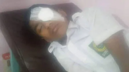 শিক্ষকের বেতের আঘাতে চোখ হারালো শিক্ষার্থী