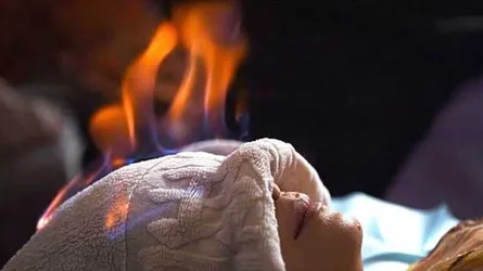 ভয়ঙ্কর রূপচর্চা : ফায়ার থেরাপি