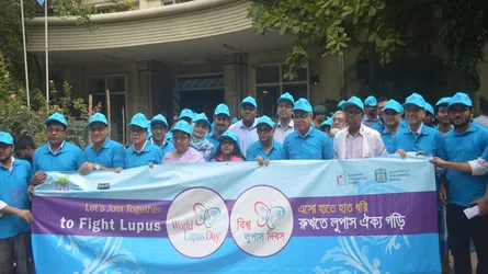 ৯০ শতাংশ লুপাস রোগী কমবয়সী নারী