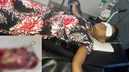 শিশুর পেটে আরেক শিশু, এলাকায় ব্যাপক চাঞ্চল্যের সৃষ্টি