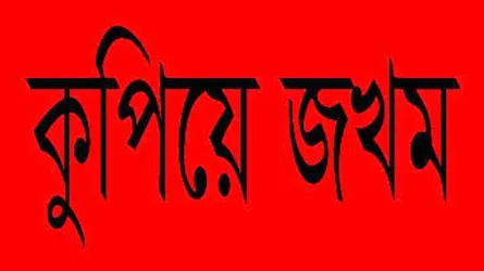 পারিবারিক কলহে মাকে কুপিয়ে জখম করেছে সৎ ছেলে