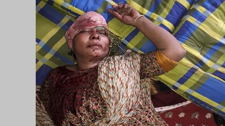 পাথরঘাটায় ইট দিয়ে শাশুড়িকে মাথা থেতলে দিলেন সাবেক ছেলের বউ