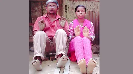 অজ্ঞাত রোগে আক্রান্ত বাবা-মেয়ে