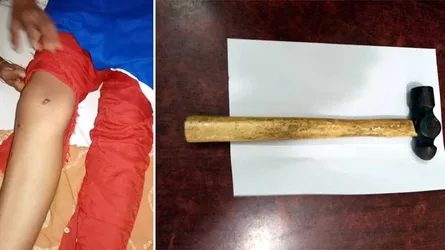 প্রেমের প্রস্তাব প্রত্যাখ্যান করায় ৮ম শ্রেণীর ছাত্রীকে হাতুড়িপেটা
