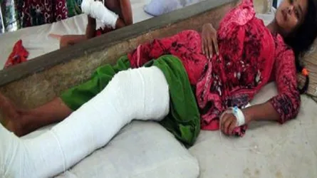 আগৈলঝাড়ায় স্কুল ছাত্রীর পা ভেঙ্গে দিলো বখাটে