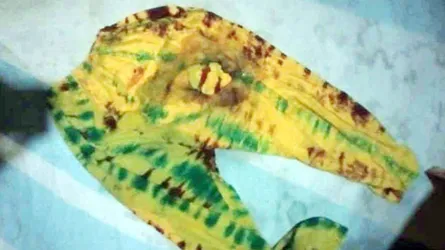 আবারো বোরকা পরে স্কুলছাত্রীকে পুড়িয়ে হত্যার চেষ্টা!