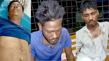 বোমা বানাতে গিয়ে হাতের কব্জি উড়ে গেল যুবকের, আহত ৫