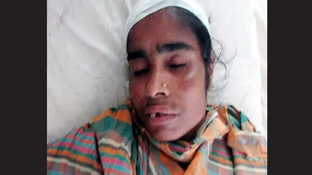 শিবগঞ্জে তুচ্ছ ঘটনায় হামলায় গৃহবধূসহ ৫ জন আহত