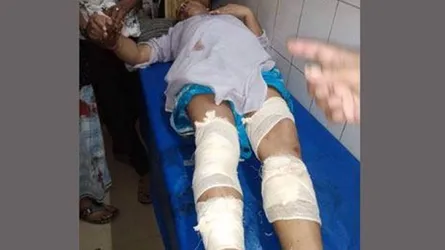 আ’লীগ নেতাকে কুপিয়ে জখমের অভিযোগ যুবলীগ নেতার বিরুদ্ধে