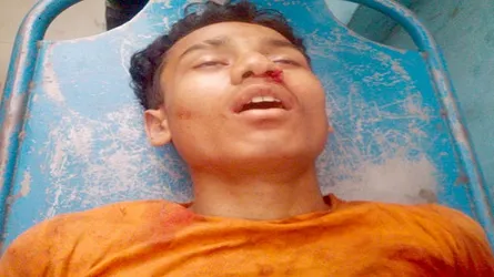 দক্ষিণ সুনামগঞ্জে দু’পক্ষের সংঘর্ষে গুলিবিদ্ধ হয়ে নিহত ১, আহত ১৫