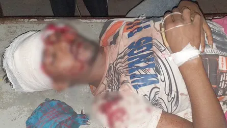 ধর্ষণের হাত থেকে রক্ষা পেল ভাবী, হাসপাতালে দেবর