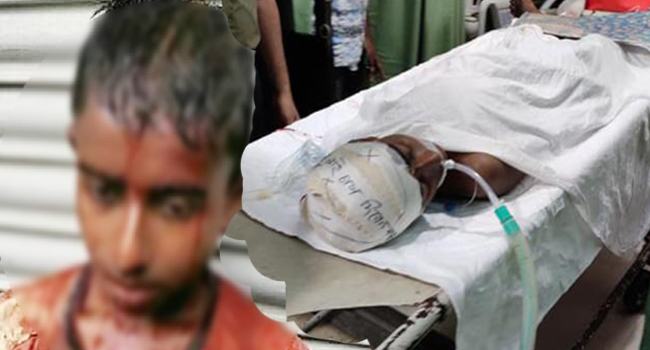 এখনো জ্ঞান ফিরেনি কিশোর শাহীনের
