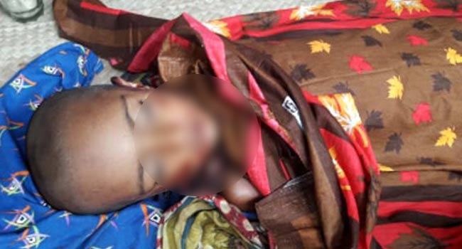 খালার বাড়ি যাওয়া হলো না শিশু উর্মিলার