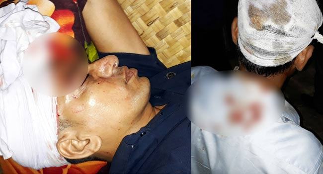 মোটর সাইকেল চুরির আসামীর গ্রেফতারকে কেন্দ্র করে হামলা