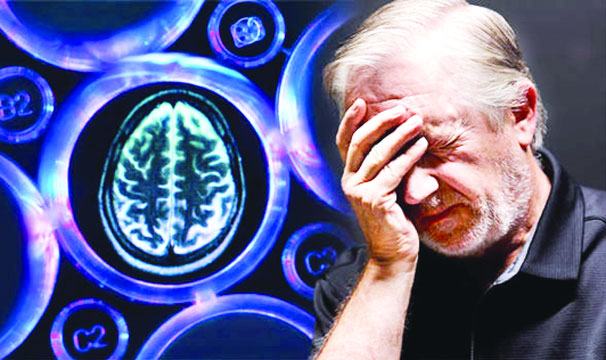 ভুলে যাওয়া রোগ : অ্যালঝেইমারস ডিজিস