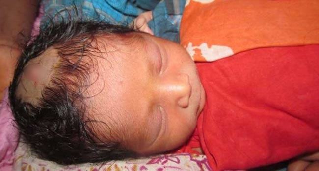 সিজার করার সময় গর্ভের সন্তানের মাথা কাটলেন চিকিৎসক