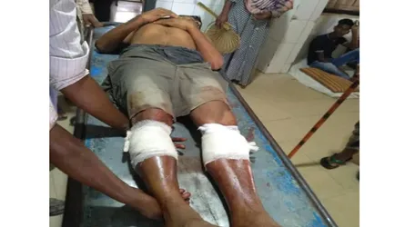 তাড়াশে ইউপি সদস্যের পা ভেঙ্গে দিলো আ.লীগ সভাপতির লোকজন