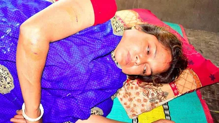 অন্তঃসত্ত্বা ইউপি সদস্যের উপর হামলা