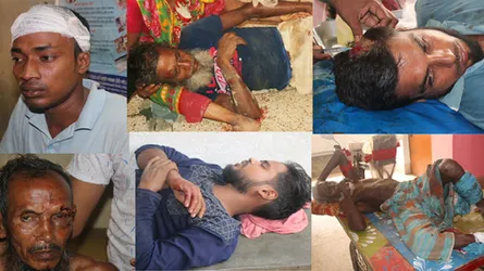 বোয়ালমারীতে আধিপত্য বিস্তারকে কেন্দ্র করে সংঘর্ষ, আহত ৩০
