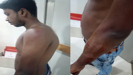 আশুলিয়ায় পুলিশ-ব্যবসায়ীদের ধাওয়া-পাল্টা ধাওয়া, পুলিশসহ আহত-৩