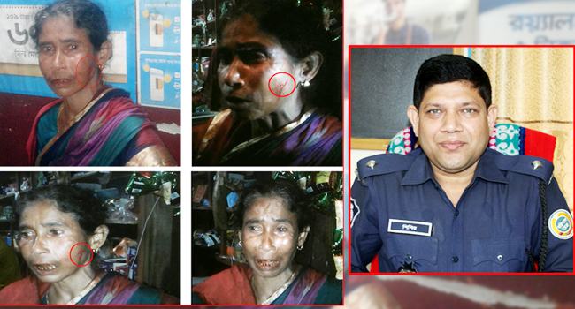 বৃদ্ধাকে পিটিয়ে রক্তাক্ত করে সিগারেটের ছ্যাকা দিলো ওসি-কনস্টেবল