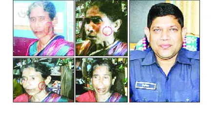 ডিআইজির কাছে নালিশ করায় উজিরপুর ওসির মারধরে রক্তাক্ত বৃদ্ধা