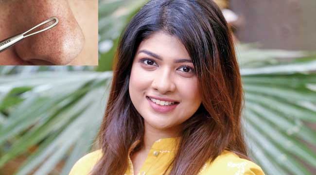 ব্ল্যাকহেড মুক্ত ত্বক